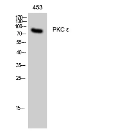 PKC ε rabbit pAb - image 1
