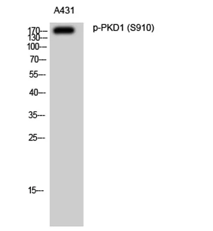 PKD1 (phospho Ser910) rabbit pAb - image 1