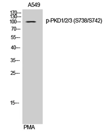 PKD1/2/3 (phospho Ser738/S742) rabbit pAb - image 1