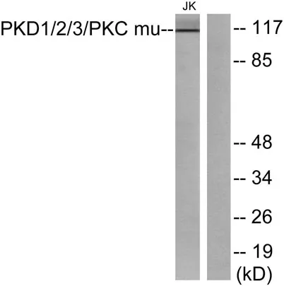 PKD1/2/3 rabbit pAb - image 1