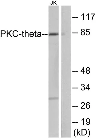 PKC θ rabbit pAb - image 1
