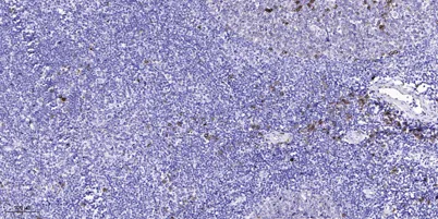 cGKII (phospho Ser126) rabbit pAb - image 1