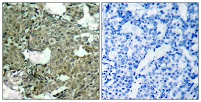 MEK-1/2 (phospho Ser222/226) rabbit pAb