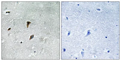 MEK-3 (phospho Thr222) rabbit pAb - image 1