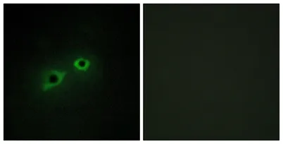 Enterokinase HC rabbit pAb - image 1