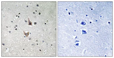 Presenilin 1 (phospho Ser357) rabbit pAb
