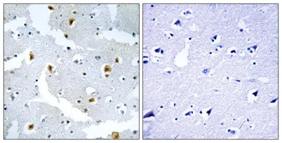 Formin 2 rabbit pAb - image 1