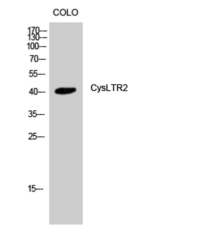 CysLTR2 rabbit pAb - image 1