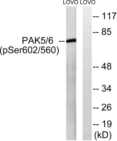 PAK5/6 (phospho Ser602/S560) rabbit pAb - image 1