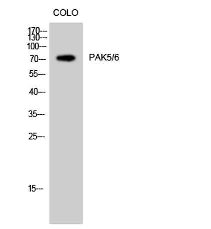 PAK5/6 rabbit pAb - image 1