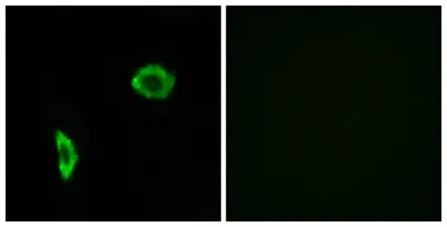 IP Receptor rabbit pAb - image 1