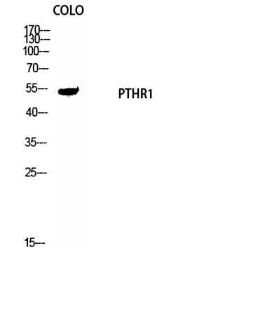 PTH/PTHrP-R rabbit pAb - image 1