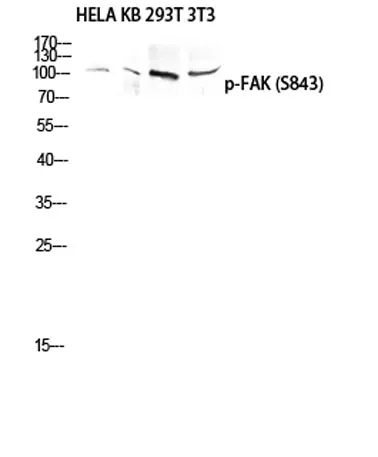 FAK (phospho Ser843) rabbit pAb