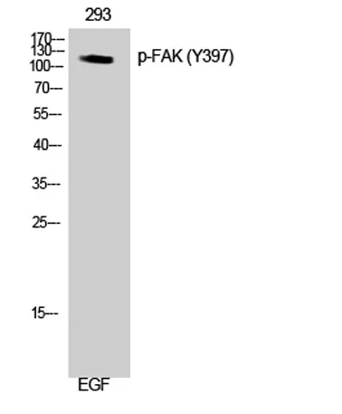 FAK (phospho Tyr397) rabbit pAb - image 1