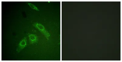 FAK (phospho Ser910) rabbit pAb - image 1