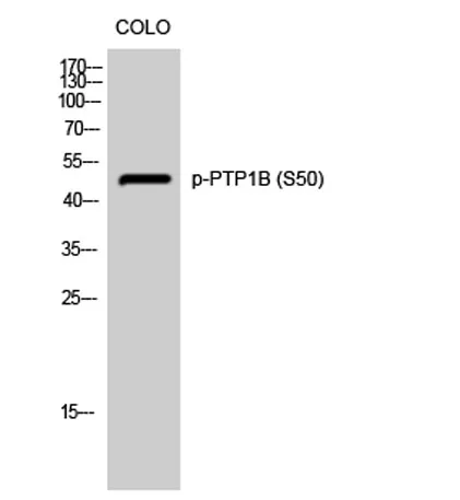 PTP1B (phospho Ser50) rabbit pAb - image 1
