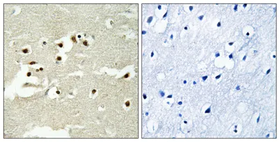 NCoA-5 rabbit pAb