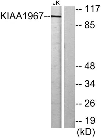 DBC-1 rabbit pAb