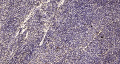 PTPα rabbit pAb - image 1