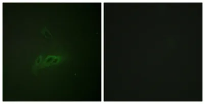 CD45 (phospho Ser1007) rabbit pAb - image 1