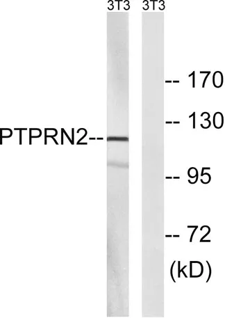 PTP IA-2β rabbit pAb - image 1