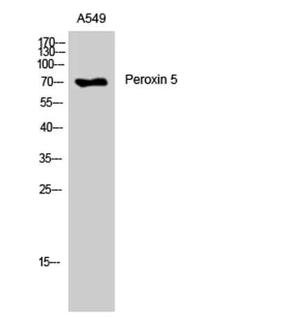 Peroxin 5 rabbit pAb - image 1