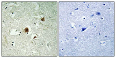 ARHGAP22 rabbit pAb