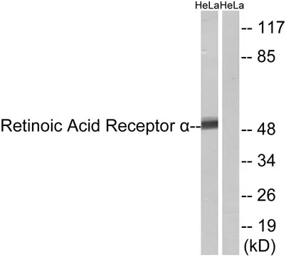 RARα rabbit pAb - image 1