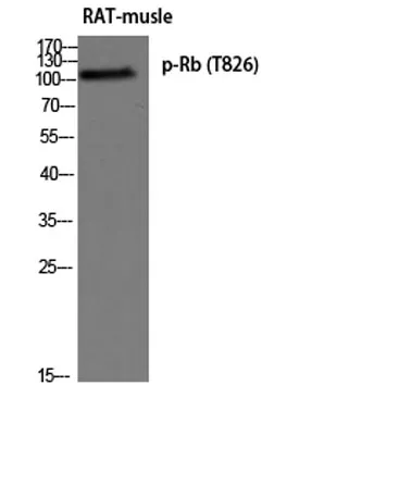 Rb (phospho Thr826) rabbit pAb - image 1