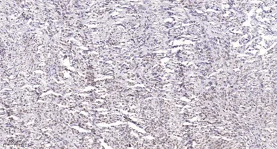 Rb (phospho Ser788) rabbit pAb