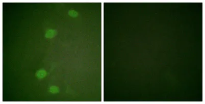 Rb (phospho Ser249) rabbit pAb - image 1