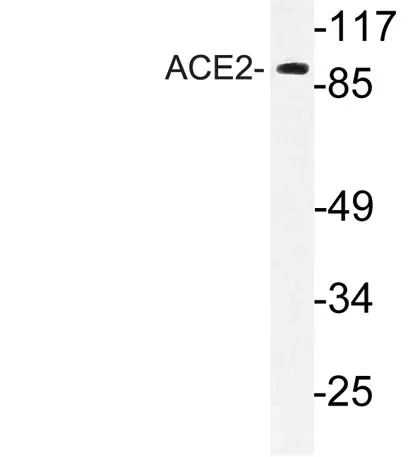 ACE2 rabbit pAb - image 1