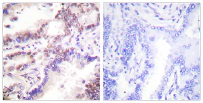 CtIP rabbit pAb - image 1