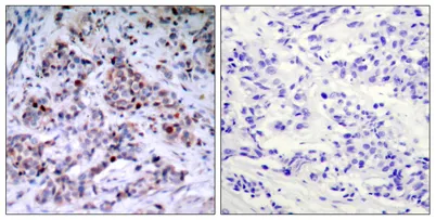 NFκB-p65 (phospho Thr435) rabbit pAb - image 1