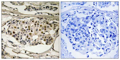 NFκB-p65 (phospho Ser281) rabbit pAb