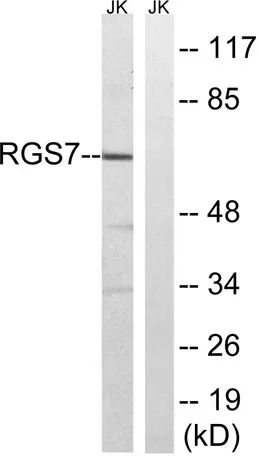 RGS7 rabbit pAb