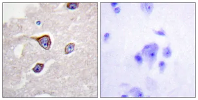 GRK 1 (phospho Ser21) rabbit pAb - image 1