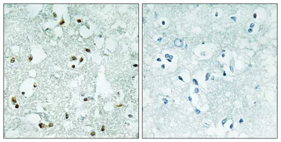 RNase Z2 rabbit pAb - image 1