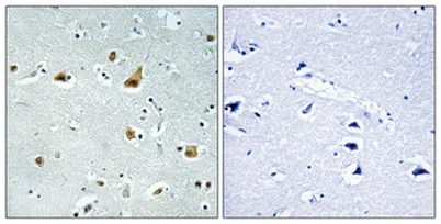 Ribosomal Protein L5 rabbit pAb - image 1
