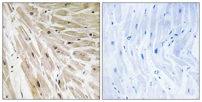 Ribosomal Protein L22 rabbit pAb