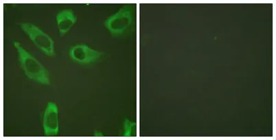 Ribosomal Protein S6 (phospho Ser240) rabbit pAb