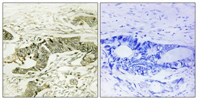 Rsk-1 (phospho Thr573) rabbit pAb - image 1