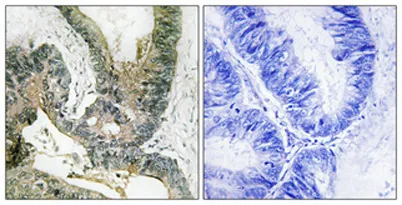 Rsk-1 rabbit pAb - image 1