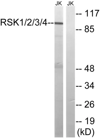 Rsk-1/2/3/4 rabbit pAb - image 1