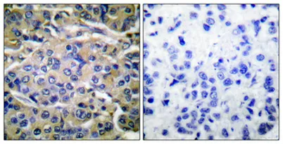 p70 S6 kinase α (phospho Thr421) rabbit pAb