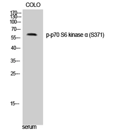 p70 S6 kinase α (phospho Ser371) rabbit pAb