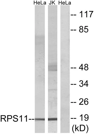 Ribosomal Protein S11 rabbit pAb