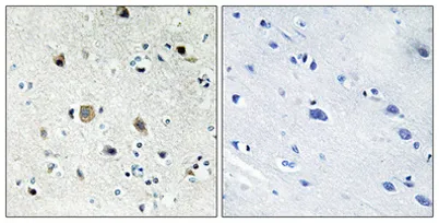 Ribosomal Protein S20 rabbit pAb