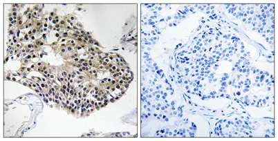 Ribosomal Protein S25 rabbit pAb