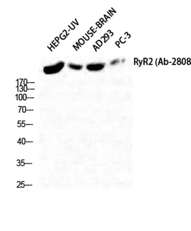 RyR-2 rabbit pAb - image 1